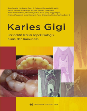 KARIES GIGI: Perspektif Terkini Aspek Biologis…