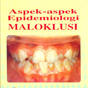 Aspek-Aspek Epidemiologi Maloklusi