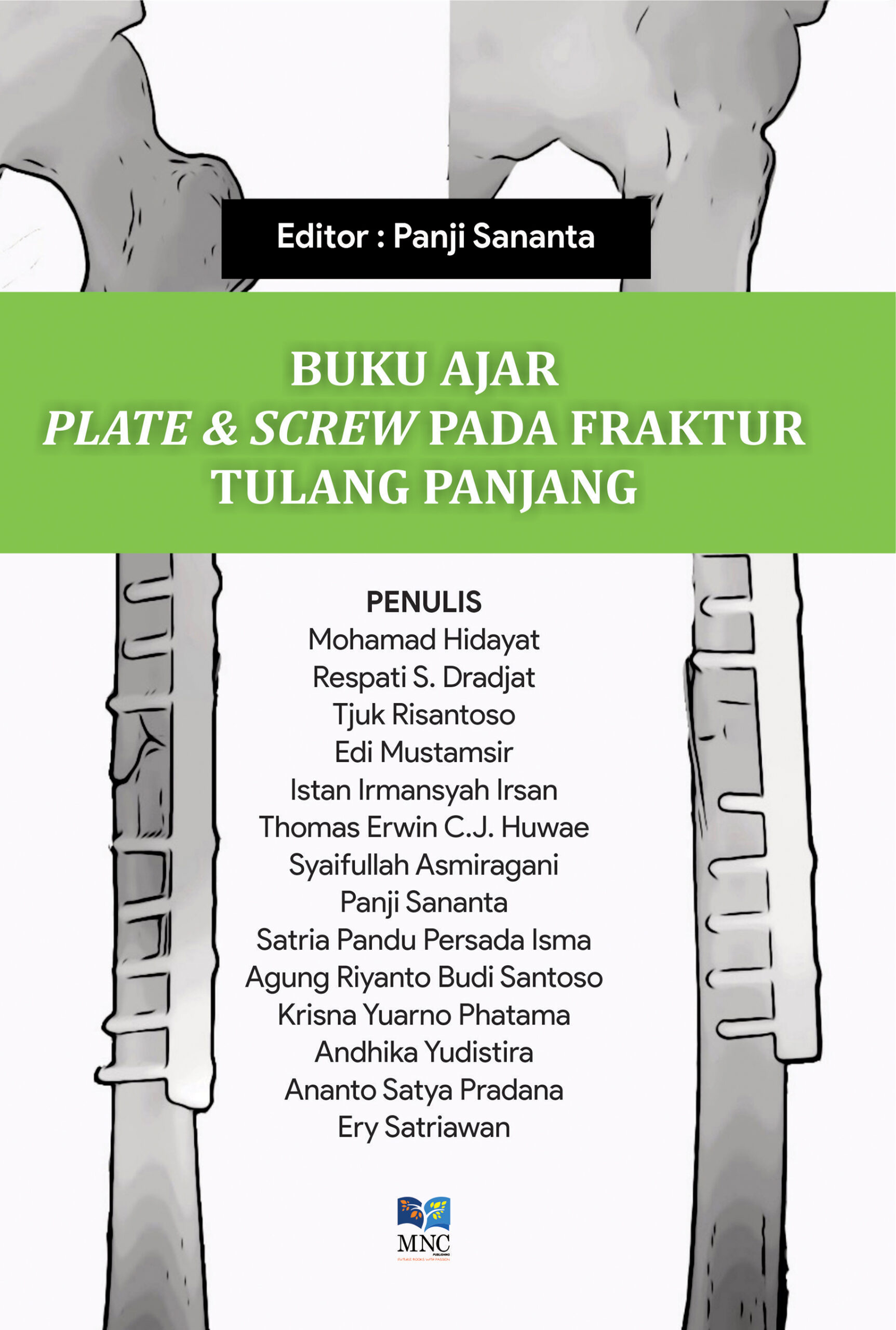 Buku Ajar Plate & Screw Pada Fraktur Tulang Panjang