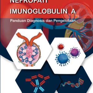 Nefropati Imunoglobulin A : Panduan Diagnosis dan Pengelolaan