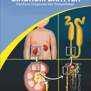 Sindrom Bartter Panduan Diagnosis dan Pengelolaan