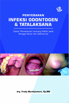 Penyebaran Infeksi Odontogen dan Tatalaksana: Dasar Pemahaman tentang Infeksi pada Rongga Mulut dan Sekitarnya