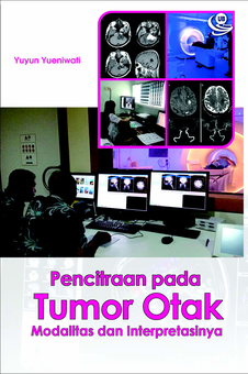 Pencitraan pada Tumor Otak: Modalitas dan Interpretasinya