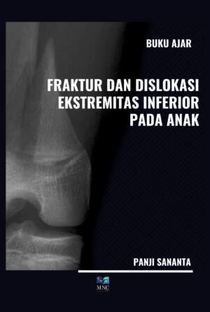 Buku Ajar Fraktur dan Dislokasi Ekstremitas Inferior Pada Anak